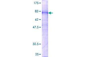 GPR151 Protein (GST tag)