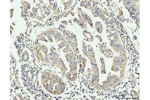 IHC analysis of GRPEL1 using anti-GRPEL1 antibody (ABIN7602643). (GRPEL1 antibody  (AA 90-217))