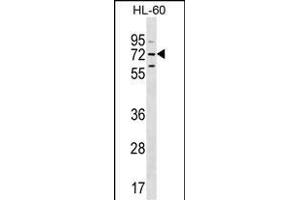 MBTD1 Antibody (C-term) (ABIN655319 and ABIN2844896) western blot analysis in HL-60 cell line lysates (35 μg/lane). (MBTD1 antibody  (C-Term))