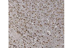 IHC analysis of FOXP1 using anti-FOXP1 antibody (ABIN7602780). (FOXP1 antibody  (C-Term))