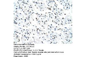 Rabbit Anti-MATR3 Antibody  Paraffin Embedded Tissue: Human Muscle Cellular Data: Skeletal muscle cells Antibody Concentration: 4. (MATR3 antibody  (N-Term))