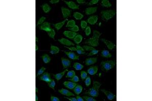 Immunofluorescence analysis of L929 cells using Bcl-2 antibody (ABIN3016825, ABIN3016826, ABIN3016827 and ABIN6219850) at dilution of 1:100. (Bcl-2 antibody  (AA 81-131))