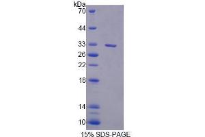 SDS-PAGE (SDS) image for phospholipase C, delta 1 (PLCD1) (AA 1-234) protein (His tag) (ABIN4990047) (PLCD1 Protein (AA 1-234) (His tag))