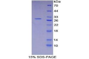 SDS-PAGE analysis of Mouse XRCC6 Protein. (XRCC6 Protein)