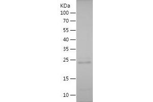 Western Blotting (WB) image for Yes-Associated Protein 1 (YAP1) (AA 350-504) protein (His tag) (ABIN7125757)