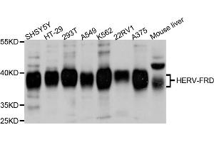 Western blot analysis of extracts of various cell lines, using ERVFRD-1 antibody (ABIN6003860) at 1/1000 dilution. (HERV-FRD Provirus Ancestral Env Polyprotein (Herv-frd) antibody)