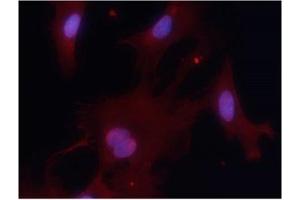 Immunofluorescence staining of methanol-fixed MEF cells using PKM1 Antibody Cat. (PKM2 antibody  (AA 399-403))