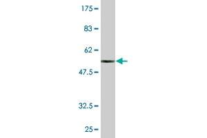 Western Blot detection against Immunogen (52. (MED6 antibody  (AA 1-246))