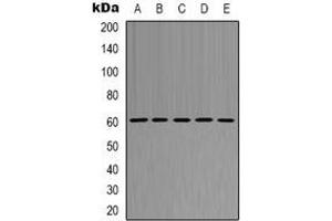 Western blot analysis of AKT1 expression in K562 (A), HepG2 (B), NIH3T3 (C), mouse spleen (D), H9C2 (E) whole cell lysates. (AKT1 antibody)