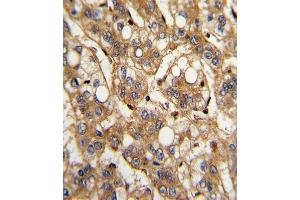 Immunohistochemistry (Paraffin-embedded Sections) (IHC (p)) image for anti-Interferon, beta 1, Fibroblast (IFNB1) (AA 39-66), (N-Term) antibody (ABIN652479)