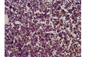 IHC image of ABIN7170587 diluted at 1:200 and staining in paraffin-embedded human lymph node tissue performed on a Leica BondTM system.