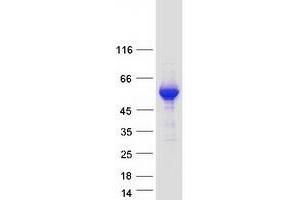 Validation with Western Blot (JMJD5 Protein (Transcript Variant 1) (Myc-DYKDDDDK Tag))