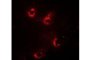 Immunofluorescent analysis of Alpha-crystallin A staining in Hela cells. (CRYAA antibody)