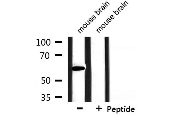 HNRPLL antibody  (Internal Region)