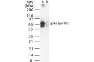 Image no. 1 for anti-SARS-Coronavirus Spike Protein (SARS-CoV S) (AA 19-35) antibody (ABIN199980) (SARS-CoV Spike antibody  (AA 19-35))