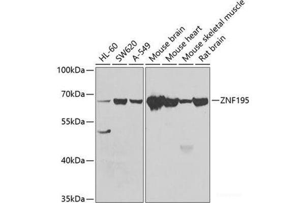 ZNF195 antibody