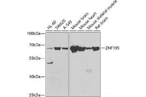 Western blot analysis of extracts of various cell lines using ZNF195 Polyclonal Antibody at dilution of 1:1000.