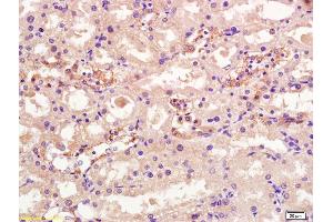 Formalin-fixed and paraffin embedded rat kidney labeled with Rabbit Anti OSTM1 Polyclonal Antibody, Unconjugated (ABIN1387308) at 1:200 followed by conjugation to the secondary antibody and DAB staining (OSTM1 antibody  (AA 21-120))