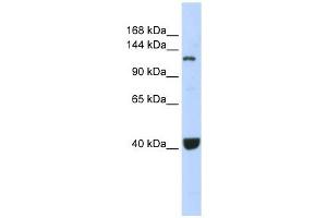 PIWIL1 antibody used at 1 ug/ml to detect target protein. (PIWIL1 antibody)