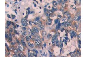 Used in DAB staining on fromalin fixed paraffin- embedded kidney tissue (ECT2 antibody  (AA 453-647))
