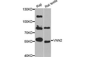 Western blot analysis of extracts of Raji and rat testis cell lines, using VNN2 antibody.