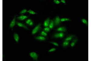 Immunofluorescence staining of Hela cells with ABIN7173496 at 1:66, counter-stained with DAPI. (NSUN2 antibody  (AA 432-509))