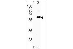 Western blot analysis of CDKL2 (arrow) using rabbit polyclonal CDKL2 Antibody (Center) (ABIN391189 and ABIN2841281).