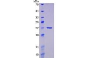 SDS-PAGE of Protein Standard from the Kit (Highly purified E. (PTGDS ELISA Kit)