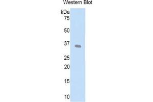 WB of Protein Standard: different control antibodies against Highly purified E. (LEFTY1 ELISA Kit)
