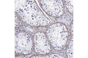 Immunohistochemical staining of human testis with FBLN5 polyclonal antibody  shows distinct positivity in capsulary cells. (Fibulin 5 antibody)