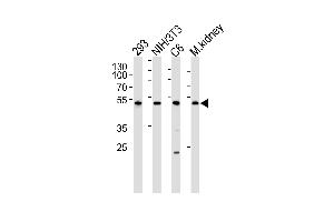 Western blot analysis of lysates from 293, mouse NIH/3T3, rat C6 cell line and mouse kidney tissue lysate(from left to right), using Mouse Cdk9 Antibody at 1:1000 at each lane. (CDK9 antibody  (C-Term))