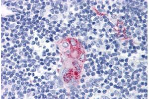 Human Thymus: Formalin-Fixed, Paraffin-Embedded (FFPE) (CD1d antibody)