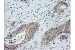 Image no. 3 for anti-Chromosome 2 Open Reading Frame 62 (C2orf62) antibody (ABIN1497054) (C2orf62 antibody)