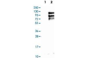 Western Blot analysis of Lane 1: negative control (vector only transfected HEK293T cell lysate) and Lane 2: over-expression lysate (co-expressed with a C-terminal myc-DDK tag in mammalian HEK293T cells) with TPX2 polyclonal antibody .