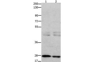 Western Blot analysis of 231 cell and Mouse testis tissue using GNRHR Polyclonal Antibody at dilution of 1:650 (GNRHR antibody)