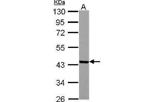 WB Image ACADM antibody detects ACADM protein by Western blot analysis. (Medium-Chain Specific Acyl-CoA Dehydrogenase, Mitochondrial (Center) antibody)