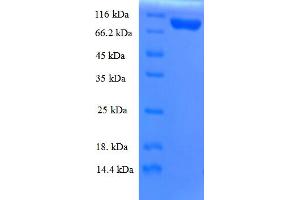 SDS-PAGE (SDS) image for Karyopherin (Importin) beta 1 (KPNB1) (AA 1-876), (full length) protein (His tag) (ABIN4976780) (KPNB1 Protein (AA 1-876, full length) (His tag))