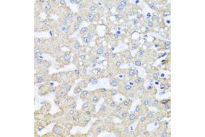 Immunohistochemistry of paraffin-embedded human liver injury using ARL6 antibody.