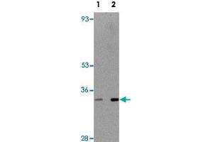 Western blot analysis of rat thymus tissue with TMEM38B polyclonal antibody  at (Lane 1) 1 and (Lane 2) 2 ug/mL dilution.