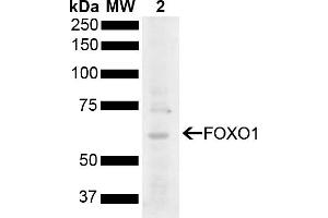 Western blot analysis of Rat Liver showing detection of 69. (FOXO1 antibody  (AA 410-520) (HRP))