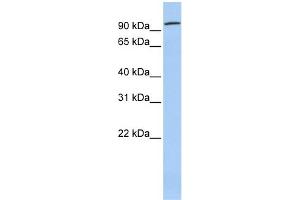 WB Suggested Anti-ZNF777 Antibody Titration:  0. (ZNF777 antibody  (Middle Region))