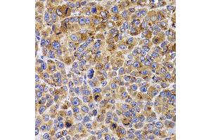 Immunohistochemistry of paraffin-embedded mouse cancer using UBE2R2 antibody (ABIN5975512) at dilution of 1/100 (40x lens). (UBE2R2 antibody)