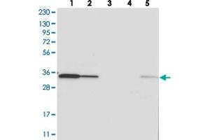 Western blot analysis of Lane 1: RT-4, Lane 2: U-251 MG, Lane 3: Human Plasma, Lane 4: Liver, Lane 5: Tonsil with C1orf74 polyclonal antibody  at 1:250-1:500 dilution. (C1ORF74 antibody)