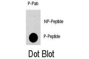 Dot blot analysis of PKMYT1 (phospho T495) polyclonal antibody  on nitrocellulose membrane.