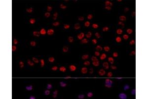Immunofluorescence analysis of 293T cells using HNRNPH1 Polyclonal Antibody at dilution of 1:100 (40x lens). (HNRNPH1 antibody)