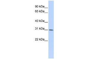 WB Suggested Anti-WDR33 Antibody Titration:  0. (WDR33 antibody  (Middle Region))