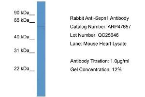 Western Blotting (WB) image for anti-Selenoprotein N, 1 (SEPN1) (C-Term) antibody (ABIN2783071) (SEPN1 antibody  (C-Term))