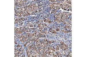 IHC analysis of SCO1 using anti-SCO1 antibody (ABIN7600609). (SCO1 antibody  (AA 21-301))