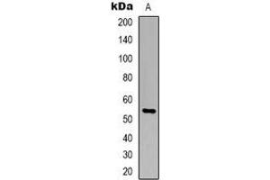 Western blot analysis of TIGD3 expression in Jurkat (A) whole cell lysates. (TIGD3 antibody  (C-Term))