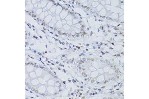 Immunohistochemistry of paraffin-embedded human colon using SNRNP70 antibody. (SNRNP70 antibody  (AA 150-250))